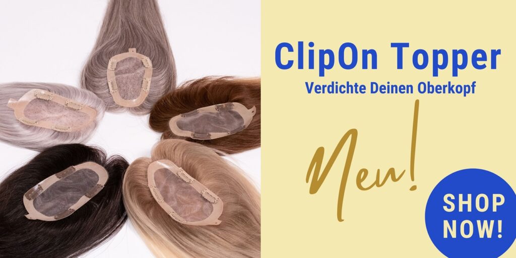 ClipOn Topper